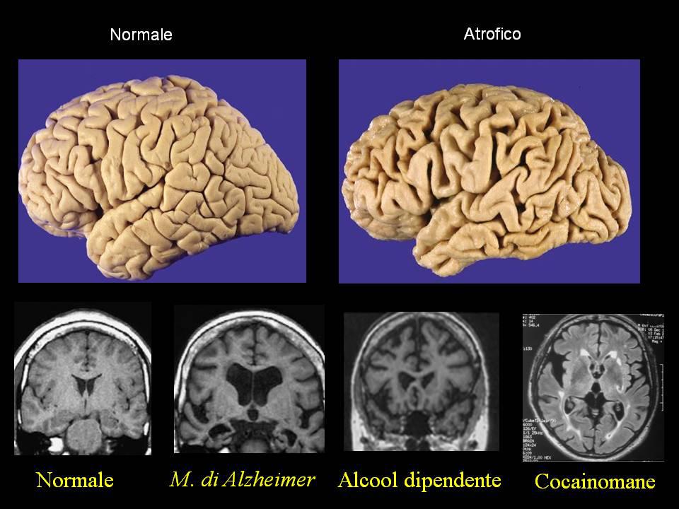 15_foto_alcol-e-droga-7