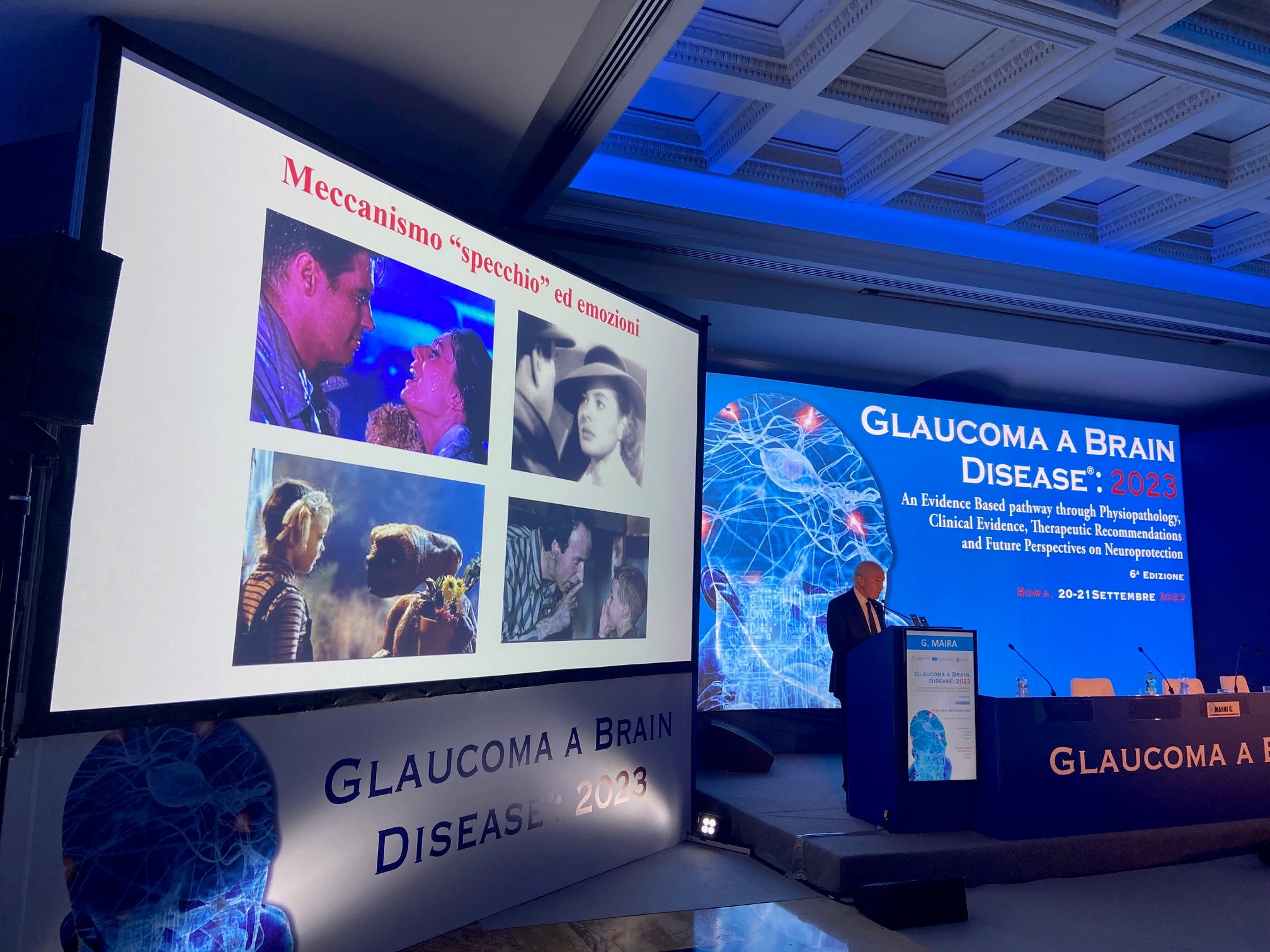 23_glaucoma-a-brain-disease-5